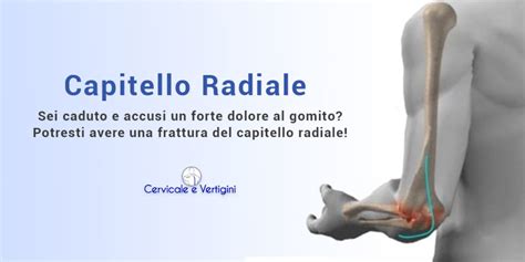 tabella punti invalidità frattura capitello radiale